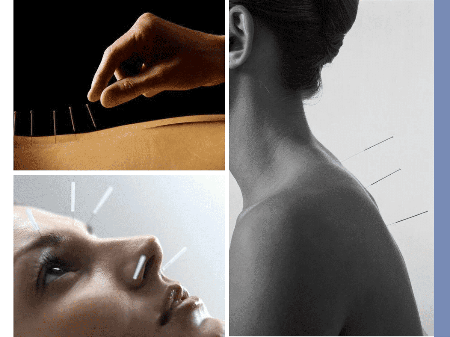 Acupunture Studio